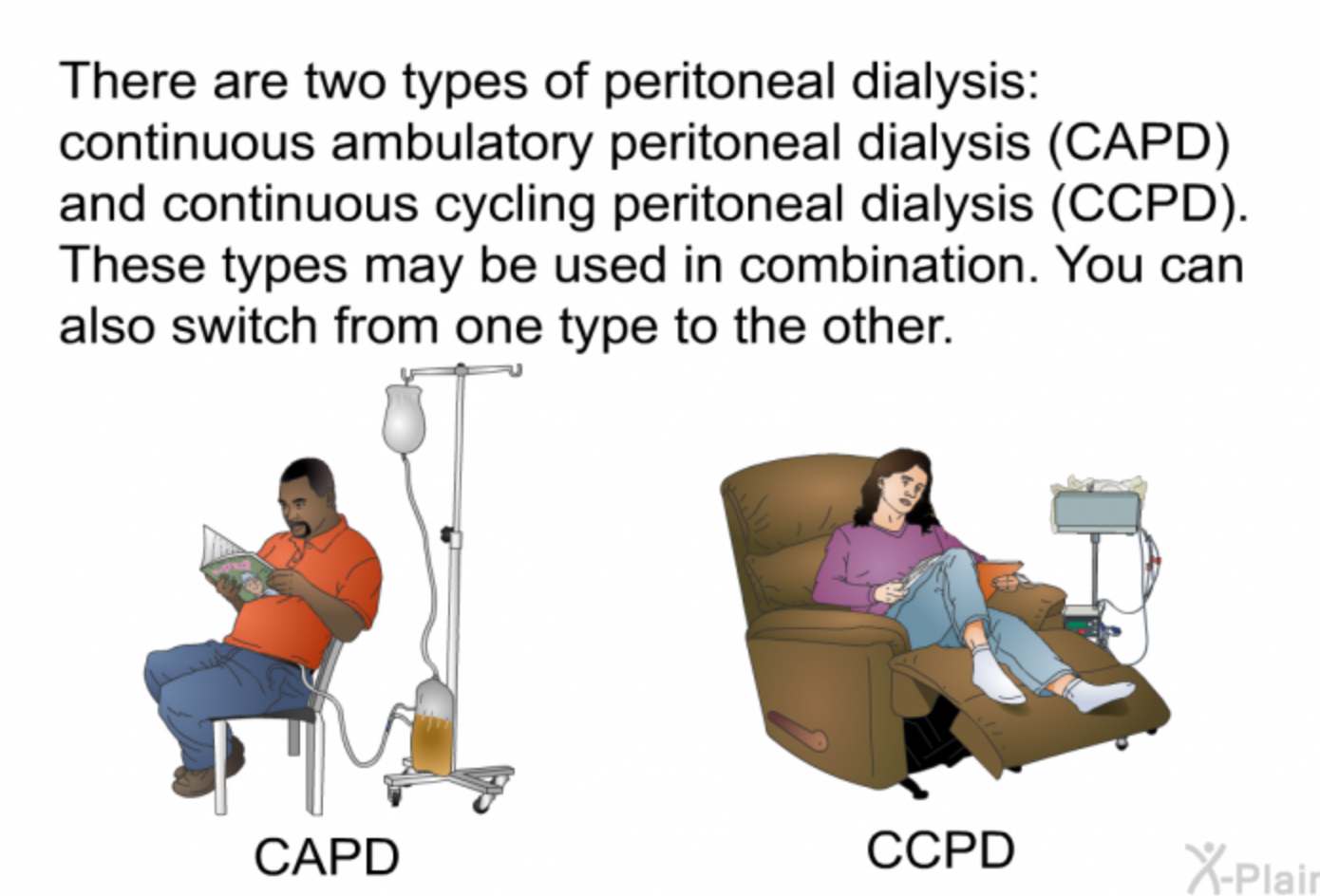 Continuous Ambulatory Peritoneal Dialysis (CAPD) is a form of renal replacement therapy that provides a convenient and effective treatment option for individuals with end-stage renal disease (ESRD)